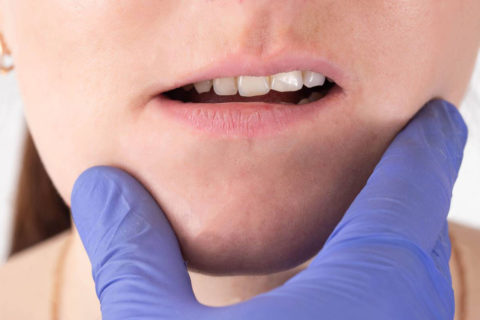 Riabilitazione funzionale ortodonzia